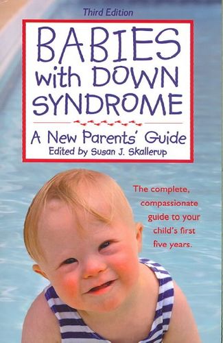 Babies With Down Syndromebabies 