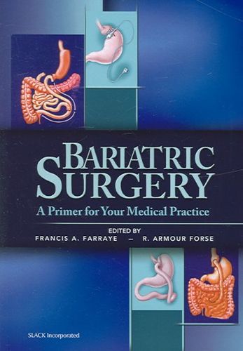 Bariatric Surgerybariatric 