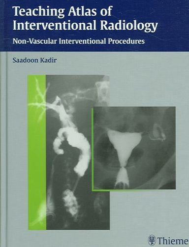 Teaching Atlas of Interventional Radiologyteaching 