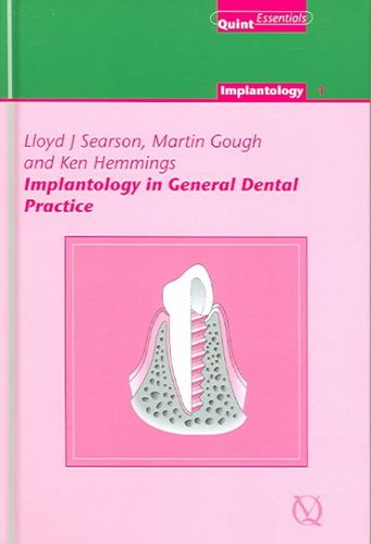 Implantology in General Dental Practiceimplantology 