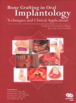 Bone Grafting in Oral Implantologybone 