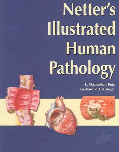 Netter's Illustrated Human Pathologynetter 