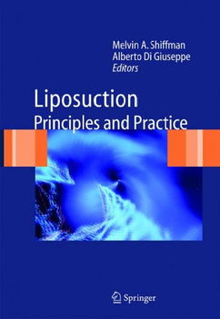 Liposuctionliposuction 