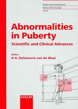 Abnormalities In Pubertyabnormalities 