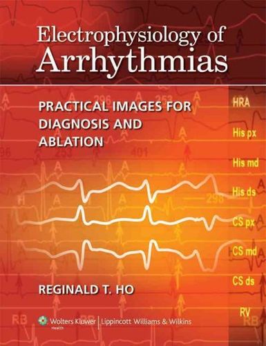 Electrophysiology of Arrhythmiaselectrophysiology 