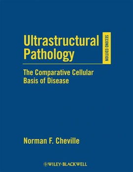 Ultrastructural Pathologyultrastructural 
