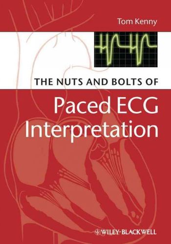 The Nuts and Bolts of Paced ECG Interpretationnuts 