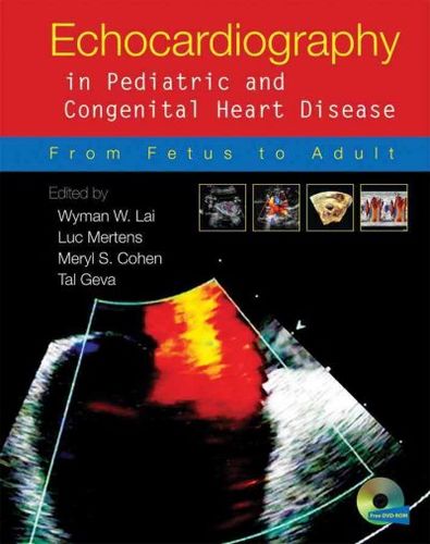 Echocardiography in Pediatric and Congenital Heart Diseaseechocardiography 