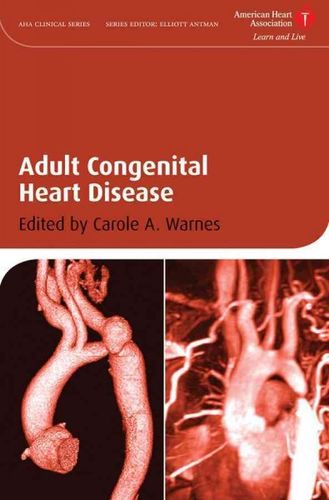 Adult Congenital Heart Diseaseadult 