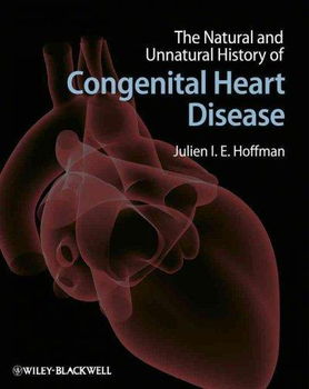 The Natural and Unnatural History of Congenital Heart Diseasenatural 