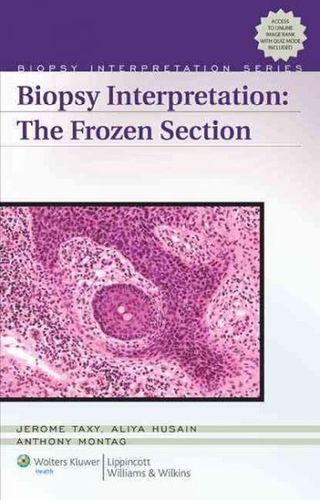 Biopsy Interpretationbiopsy 