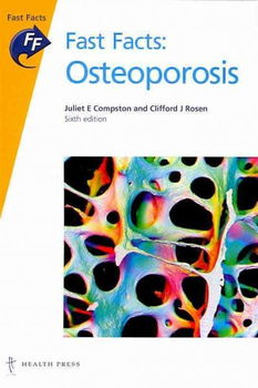 Osteoporosisosteoporosis 