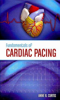 Fundamentals of Cardiac Pacingfundamentals 