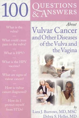 100 Questions & Answers About Vulvar Cancer and Other Diseases of the Vulva and Vaginaquestions 