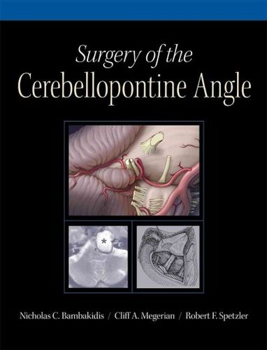 Surgery of the Cerebellopontine Anglesurgery 