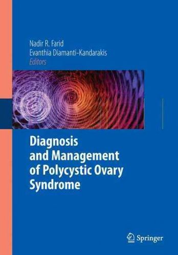 Diagnosis and Management of Polycystic Ovary Syndromediagnosis 