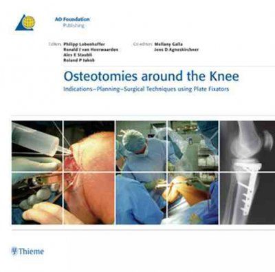Osteotomies Around the Kneeosteotomies 