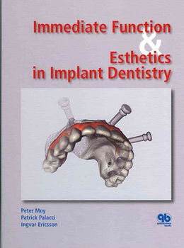 Immediate Function & Estetics in Implant Denistryimmediate 