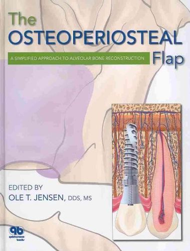 The Osteoperiosteal Flaposteoperiosteal 