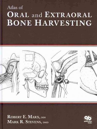 Atlas of Oral and Extraoral Bone Harvestingatlas 