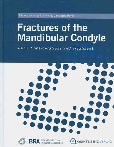 Fractures of the Mandibular Condylefractures 