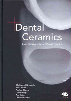 Dental Ceramicsdental 