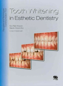 Tooth Whitening in Esthetic Dentistrytooth 