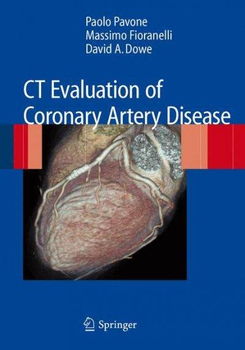 CT Evaluation of Coronary Artery Diseaseevaluation 