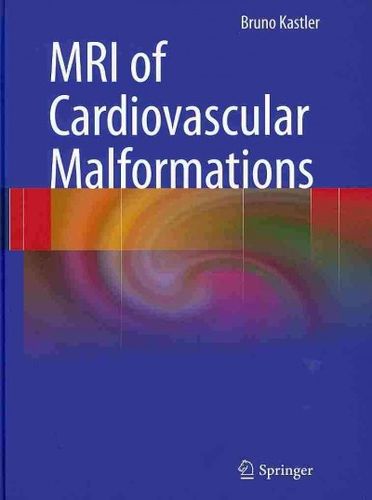 MRI of Cardiovascular Malformationsmri 