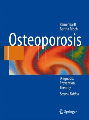 Osteoporosisosteoporosis 