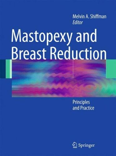 Mastopexy and Breast Reductionmastopexy 