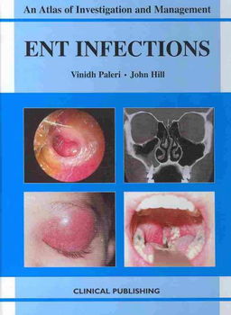 ENT Infectionsent 