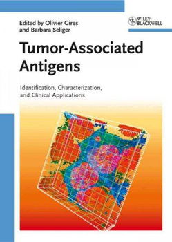 Tumor-Associated Antigenstumor 