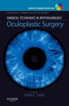 Oculoplastic Surgeryoculoplastic 