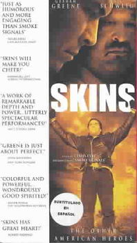 SKINSskins 