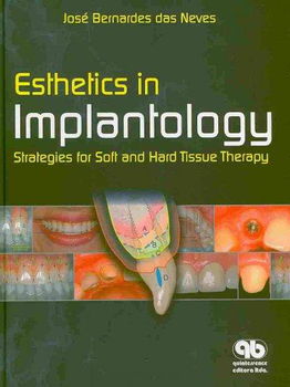 Esthetics in Implantologyesthetics 