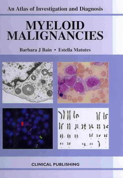 Myeloid Malignanciesmyeloid 