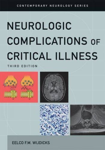 Neurologic Complications of Critical Illnessneurologic 
