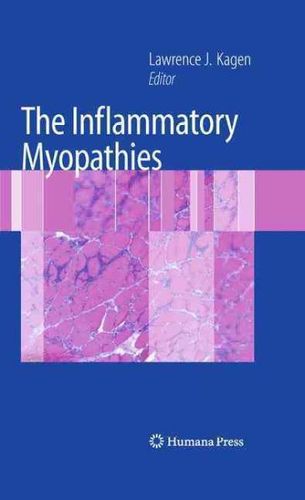 The Inflammatory Myopathiesinflammatory 