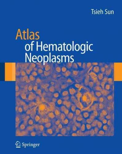 Atlas of Hematologic Neoplasmsatlas 