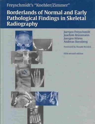 Freyschmidt's Koehler/Zimmer's Borderlands of Normal and Early Pathological Findings in Skeletal Radiographyfreyschmidt 