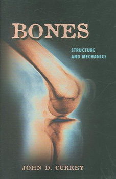 Bonesbones 