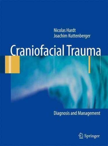 Craniofacial Traumacraniofacial 