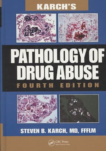 Karch's Pathology of Drug Abusekarch 