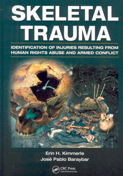 Skeletal Traumaskeletal 