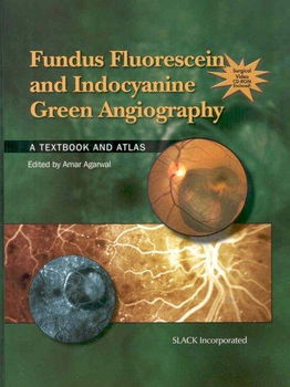 Fundus Fluorescein and Indocyanine Green Angiographyfundus 