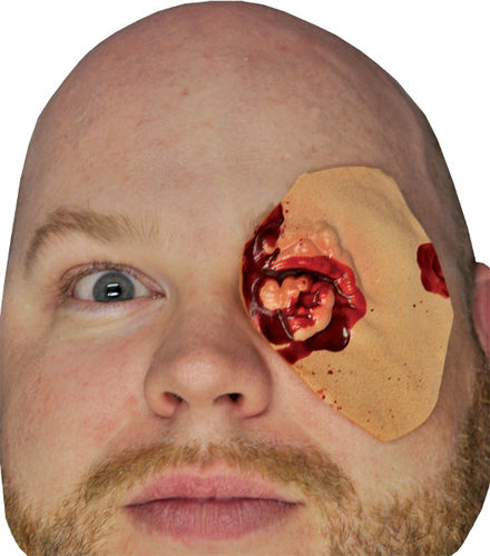 Plucked Eye Prosthetic