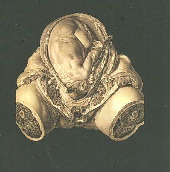 ORCUSTUS